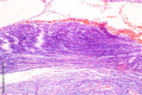 Image result for Finger Under Microscope