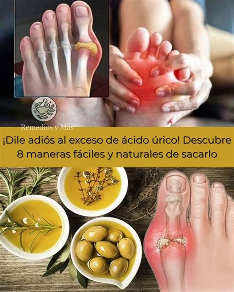 Dile Adiós al Exceso de Ácido Úrico: 8 Maneras Naturales y Efectivas - TU SALUD