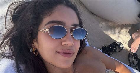 5 Ways To Soothe Sunburnt Skin In Monsoon