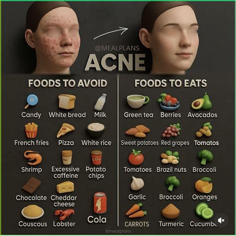 Top Foods To Avoid If You Struggle With Acne