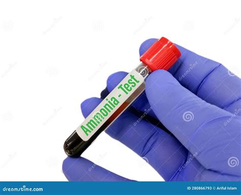 Blood Sample Tube for Blood Gas Ammonia Test. Stock Image - Image of fever, scarlet: 280866793
