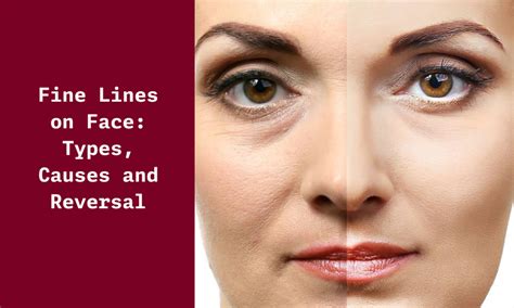 Fine Lines on Face: Types, Causes and Reversal - Ningen Skin Sciences ...