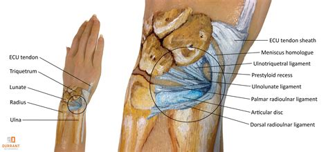 Pin on Hand and Wrist Injuries