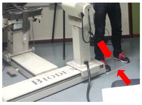 The Effect of Ice on Shoulder Proprioception in Badminton Athletes