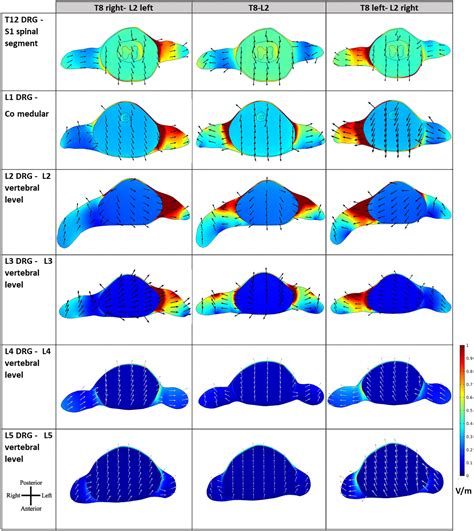 Frontiers | Lumbar trans-spinal direct current stimulation: A modeling ...