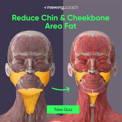 How to Get Rid of Chubby Cheeks: 13 Most Effective Ways | Mewing.coach