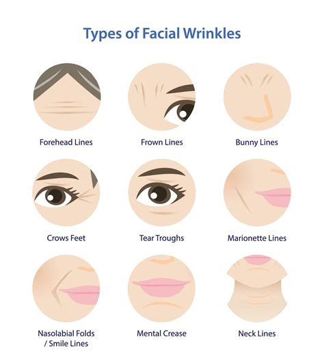 Types of facial wrinkles vector icon set on white background. Icon set of Forehead, Bunny ...