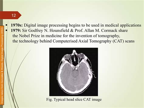 Image result for Digital Image Processing Lecture