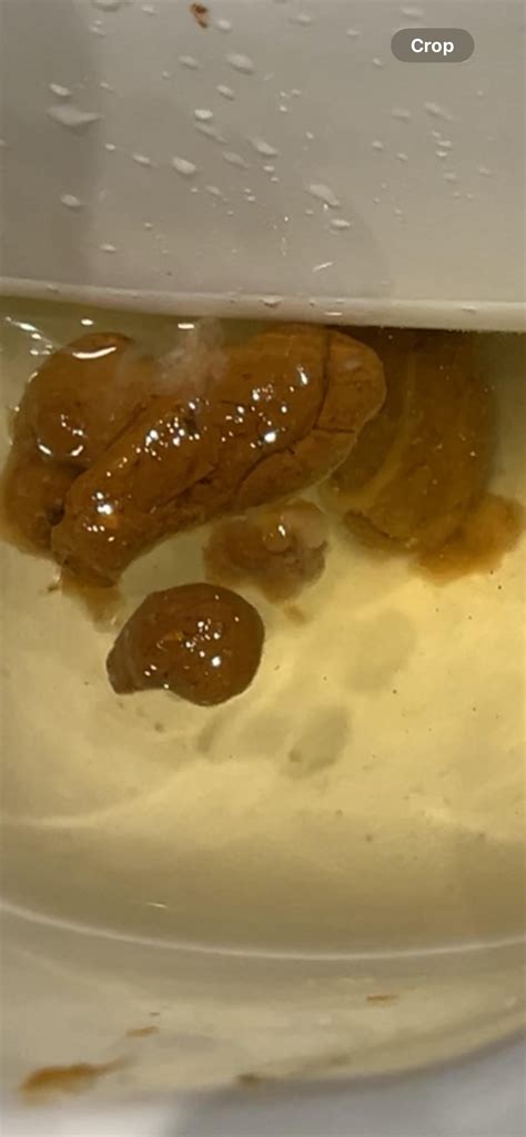 mucus in stool!! : r/poop