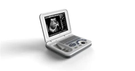 Ultrasound Scanner Machine 的图像结果