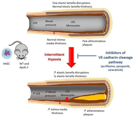 Inhibition of Vascular Endothelial Cadherin Cleavage Prevents Elastic ...