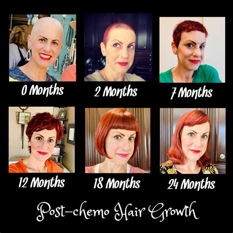 My hair’s journey through breast cancer – Artofit