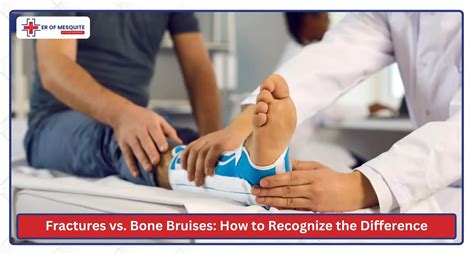 How to Tell if a Bone is Fractured or Bruised | ER of Mesquite