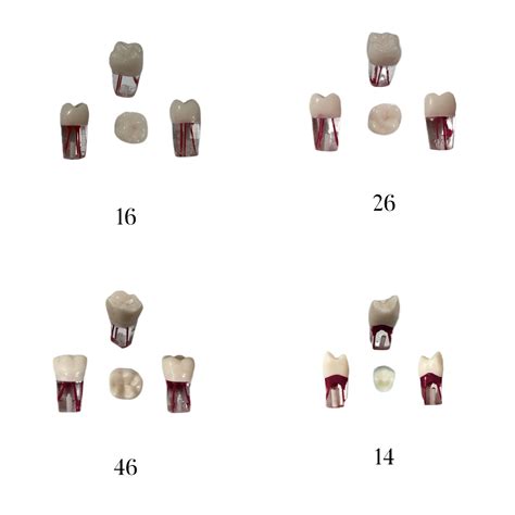 Endo RCT Training Tooth – ADC Compatible – Moiadcdental