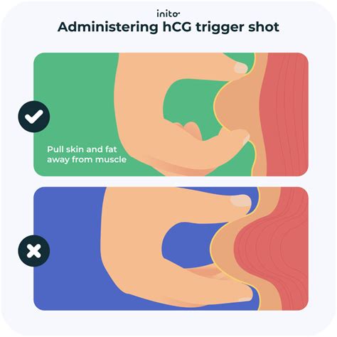 Six Common hCG Trigger Shot Mistakes to Avoid - Inito
