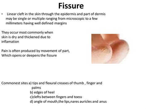 lesions and abrasions.pptx