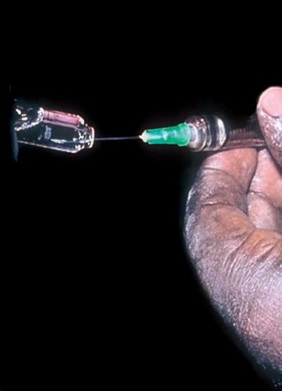 Subconjunctival Injection 的图像结果