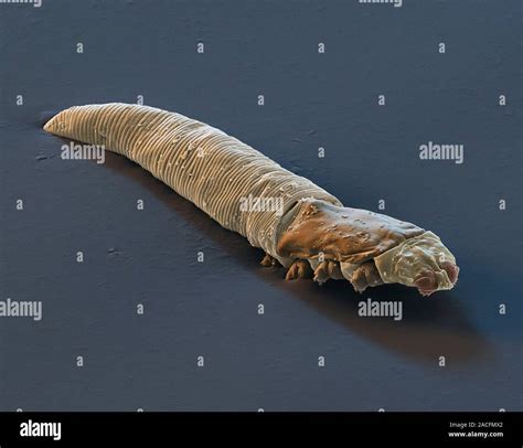 Demodex Eyelash Mites