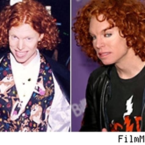 Carrot Top Face Surgery
