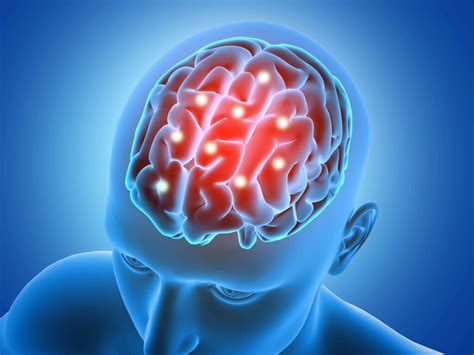 Brain Cancer Signs: Key Symptoms to Know - Apollo Proton