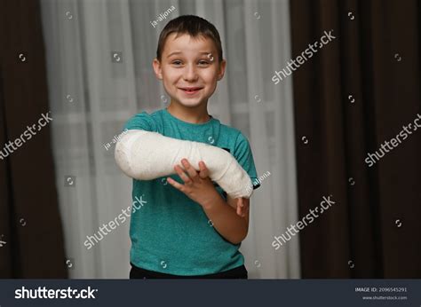 Broken Hand Cast