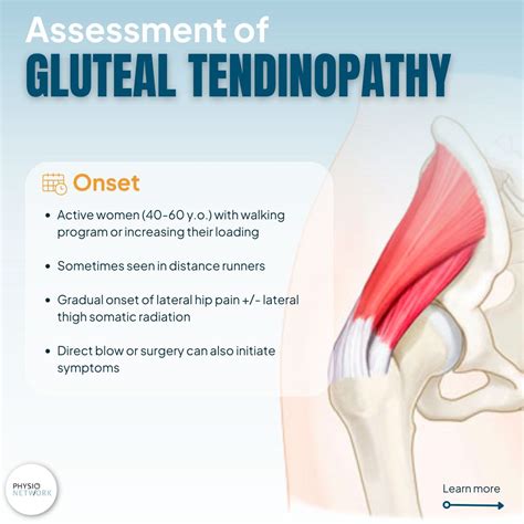 Gluteal Tendinopathy Treatment