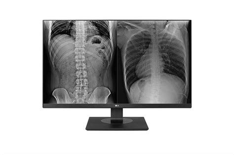 LG 8MP Clinical Review Monitor - 27HJ713C-B | LG India Business