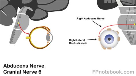 Cranial Nerve 6 Palsy