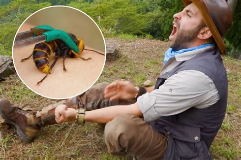 Giant Hornet Stings