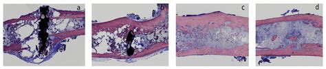 Human Body-Fluid-Assisted Fracture of Zinc Alloys as Biodegradable ...