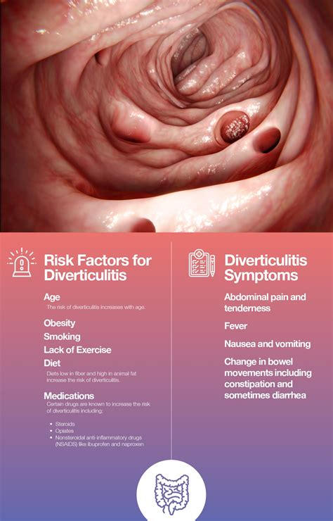 Diverticulosis and Diverticulitis Explained – The Amino Company