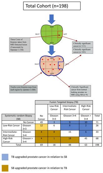 Predicting the Performance of Concurrent Systematic Random Biopsies ...