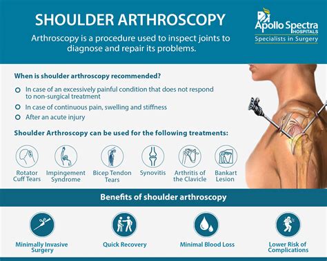 Shoulder Surgery Driving at Jose Norman blog