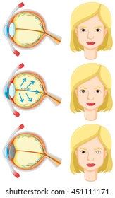 Image result for Solving Eye Problem