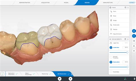 CEREC Dental Milling Machines | Dentsply Sirona IN