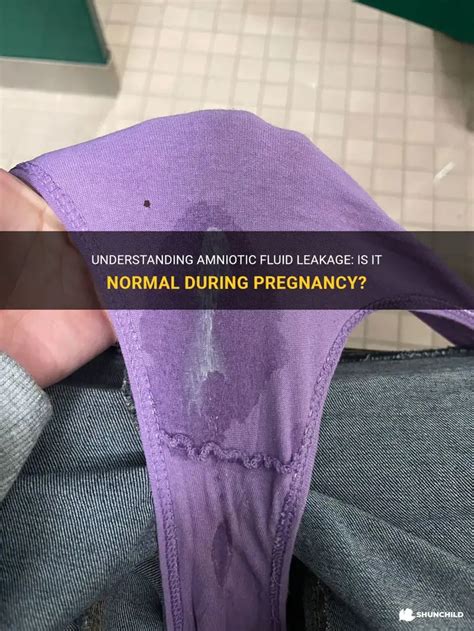 Understanding Amniotic Fluid Leakage: Is It Normal During Pregnancy ...