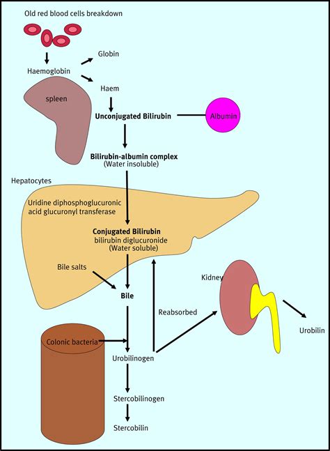 Conjugated hyperbilirubinaemia - Paediatrics and Child Health