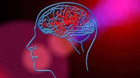 World Brain Tumour Day 2022: Date, Symptoms, Treatments