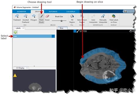Image result for Volume Segmenter MATLAB Tutorial