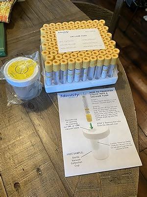 Identify Health Vacuum Urine Specimen Tubes | 500 India | Ubuy