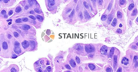 "Periodic Acid-Schiff (PAS) stain" | StainsFile