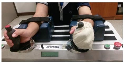 A Pilot Randomized Controlled Trial of Botulinum Toxin Treatment ...