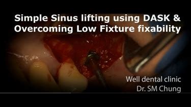 Rainbow 3D Viewer Tutorial - Dentium CBCT Software Demonstration