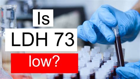 Is LDH 73 low, normal or dangerous? What does Lactate dehydrogenase level 73 mean?