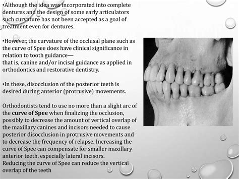 OCCLUSION | PPTX