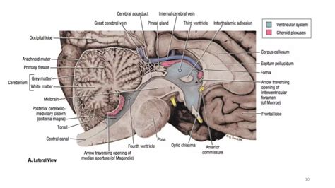 CP Angle Tumors (Vestibular Schwannoma) | PPTX