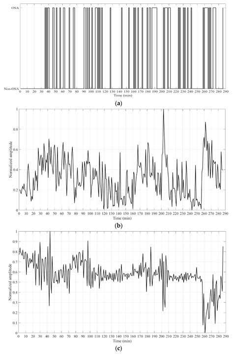 An Oximetry Based Wireless Device for Sleep Apnea Detection