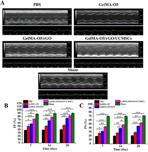 (A) Representative echocardiograph images for PBS, GelMA-O5 ...
