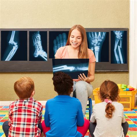 Sayglossy 15 Pcs Broken Bones x Ray Set Human x Rays Black and India | Ubuy