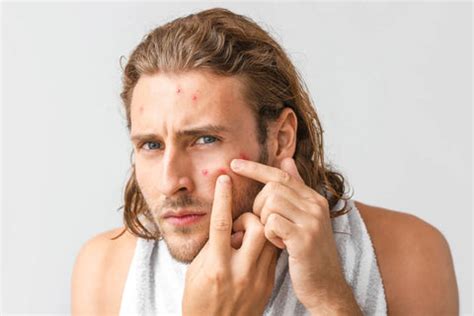 Amba Haldi For Skin Problems | Heal Skin Naturally – VedaOils